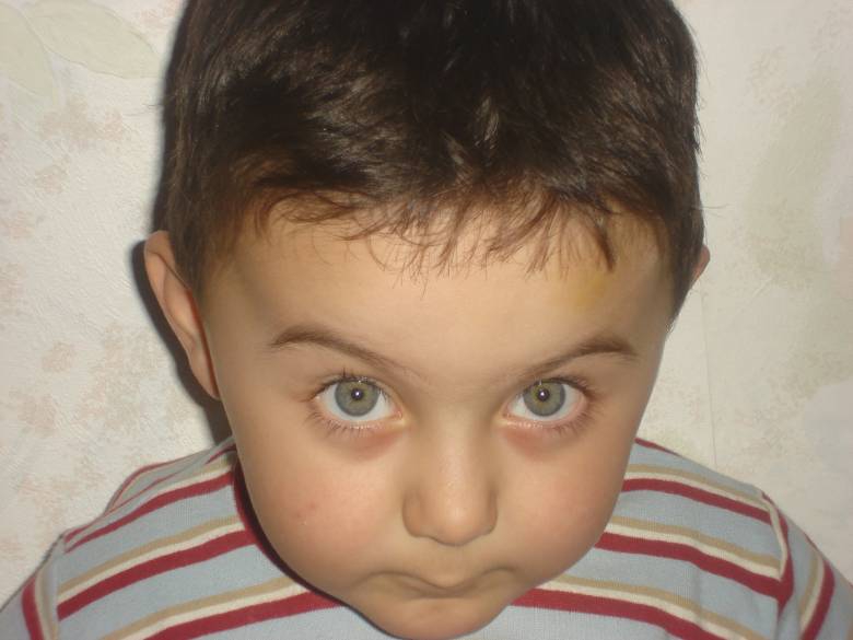 No comment
