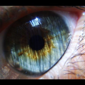 Eye